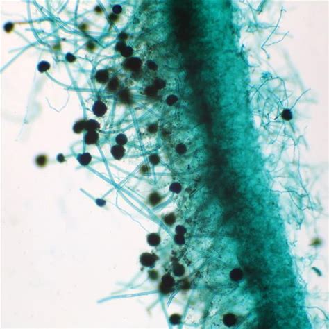 Aspergillus Microscope Slides - Walmart.com