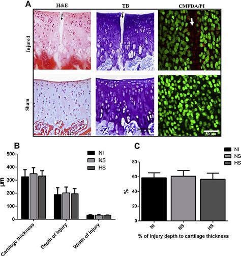 Figure 1 from The use of hyperosmotic saline for chondroprotection: implications for orthopaedic ...