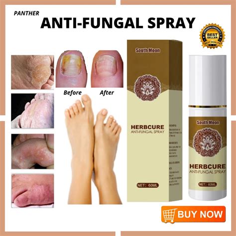 Effective Anti Fungal Foot Spray Anti Sweat Anti Odor Cooling Effect Anti Itch Alipunga Hadhad ...