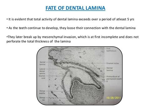 Development of tooth