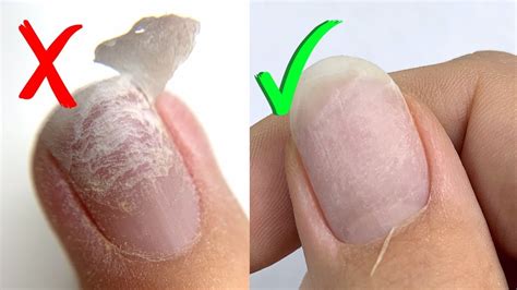 Mistakes in Gel Manicure Removal | Avoid Nail Damage - YouTube