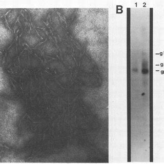 Electromicrograph of intermediate filaments assembled in vitro from... | Download Scientific Diagram