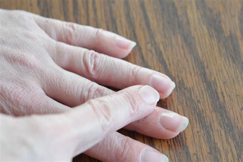 How to Heal a Damaged Cuticle | LIVESTRONG.COM