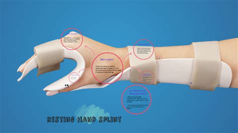 resting hand splint by thivyaa asokan on Prezi