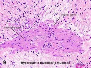 American Urological Association - Urinary Bladder: Lamina Propria