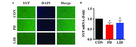 | Gene and protein expression of synaptophysin (SYP) in the right... | Download Scientific Diagram