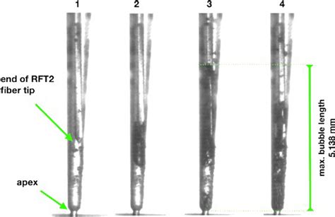 Picture illustrating the cavitation process, bubble formation, and ...