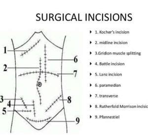 Abdominal Incisions And Sutures In Gynecologic Oncological Surgery | My ...