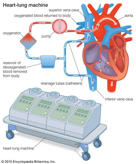 Artificial Heart Diagram