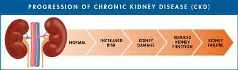 CHRONIC KIDNEY DISEASE – Caritas Medical Center