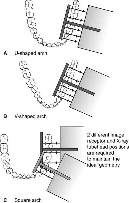 10: Bitewing radiography | Pocket Dentistry | Dental assistant study ...