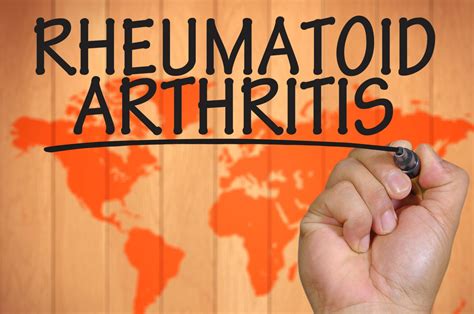 Understanding Arthritis: What Sets Rheumatoid Arthritis Apart from ...