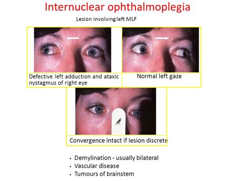 Brain stem Anterior view - ppt video online download