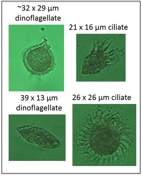 Microzooplankton: Lawnmowers of the Sea - Schmidt Ocean Institute