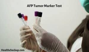 AFP Tumor Marker Test - Purpose, Preparation, Normal Range & Results