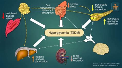 Pathophysiology and Clinical Manifestations | Type 2 diabetes mellitus Case Study