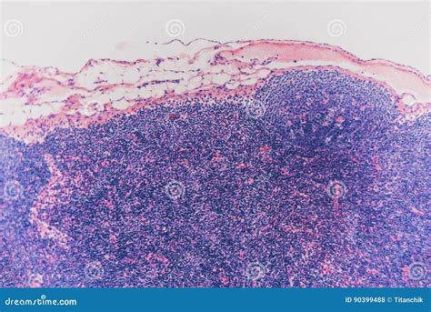 Biology Abstract- Cell Lymph Node Dog Stock Photo - Image of biology, animal: 90399488