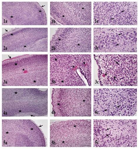 Fetal brain histology. 1a) C group. Pia mater (arrow), neurons and ...