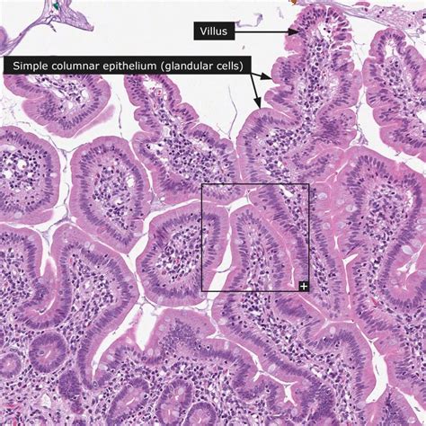 Normal: Duodenum - mucosa | Normal HE | Pinterest