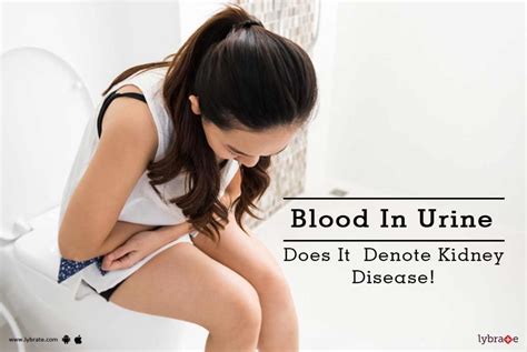 Blood In Urine - Does It Denote Kidney Disease! - By Dr. Hasit Patel ...