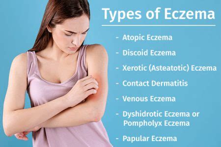 7 Types Of Eczema