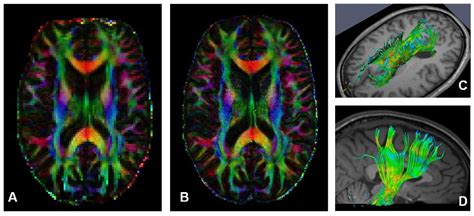 Validation of Diffusion MRI | Neuroimaging - Medical University of Graz