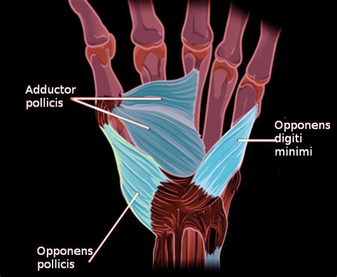 [Figure, Opponens pollicis Image courtesy O.Chaigasame] - StatPearls ...