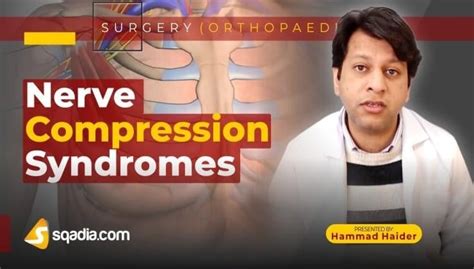 Nerve Compression Syndromes