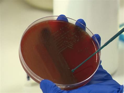 Capsular Serotyping of Streptococcus pneumoniae Using the Quellung ...