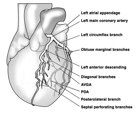 Iatrogenic Left Circumflex Coronary Occlusion Following, 58% OFF