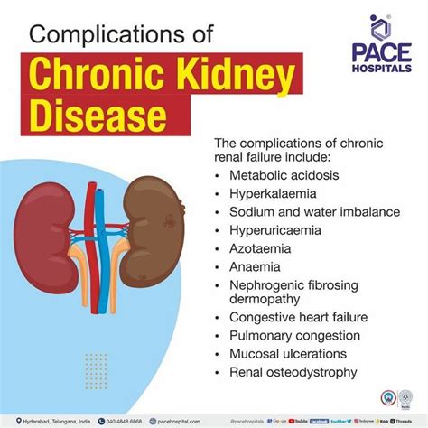 Chronic Kidney Disease Symptoms, Stages, Causes, Risk, 41% OFF