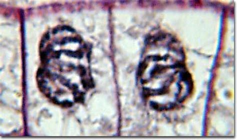 Prometaphase Microscope