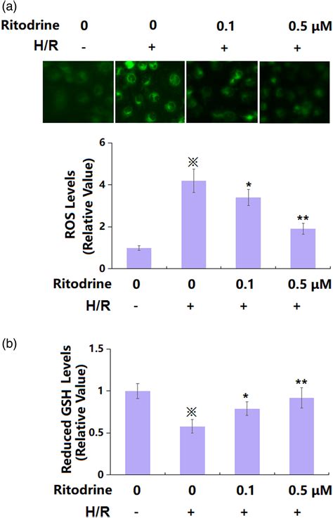 The protective effects of ritodrine against hypoxia/reoxygenation ...