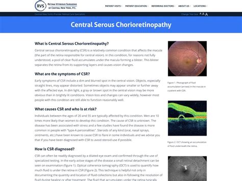 Central Serous Chorioretinopathy | Retina-Vitreous Surgeons of CNY