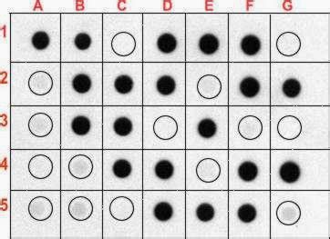 Dot Blot Hybridization Technique: Definition, Principle, Procedure and Applications