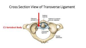 Transverse Ligament Test