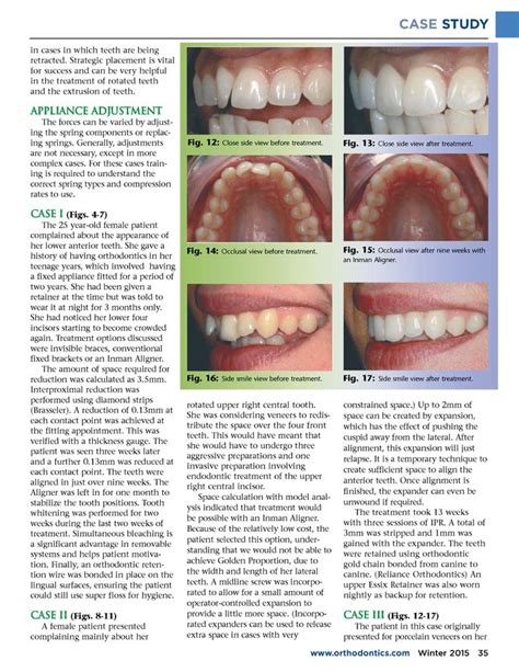 Journal of the American Orthodontic Society Winter 2015 | Orthodontics ...