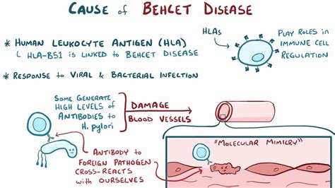 behcet's disease,what to know?