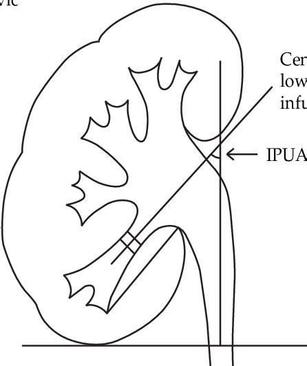 Calyces Definition Anatomy