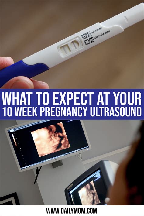 What To Expect At Your First Pregnancy Ultrasound » Read Now!