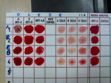 ABO blood grouping | scientistlaboratory