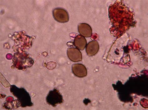 Which one of this species is Chaetomium?