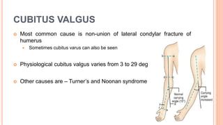 Cubitus varus and valgus | PPT