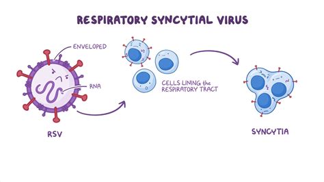 Medications for respiratory syncytial virus (RSV): Nursing pharmacology ...