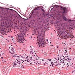 Human Skin Layers Histology