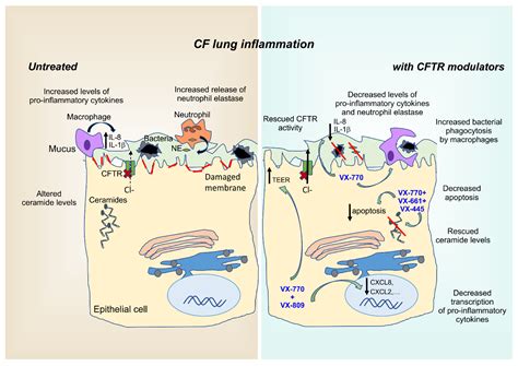 IJMS | Free Full-Text | Dysfunctional Inflammation in Cystic Fibrosis Airways: From Mechanisms ...