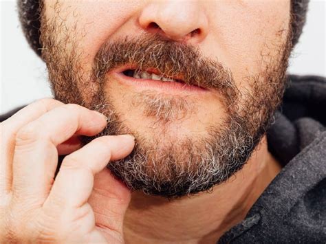 Suffering from beard dandruff? Here's your A-Z guide to say goodbye to ...