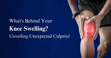 What's Behind Your Knee Swelling? Unveiling Unexpected Culprits ...