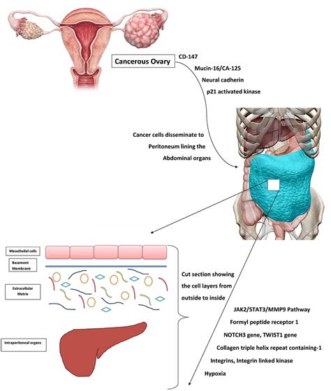 Cureus | Extracellular Matrix: A Treasure Trove in Ovarian Cancer ...