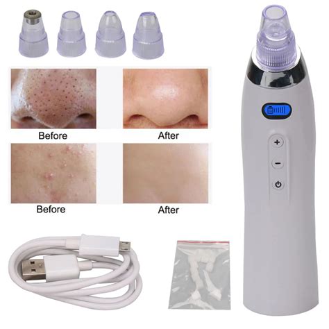 Electric Pore Cleaner Acne Blackhead Remover Skin Care Device Facial ...